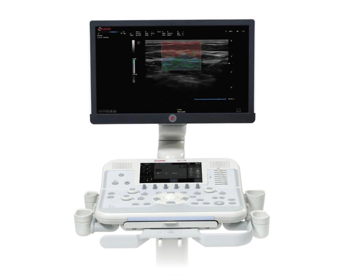 AUTORIZADA ULTRASSOM ESAOTE MYLAB X6 GOIANIA